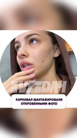 Какой кошмар 😱 Валю Карнавал шантажировали откровенными фото
