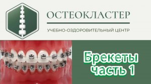 Брекеты ч. 1