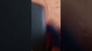 я вышел из больницы