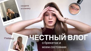 vlog / честно о БРЕКЕТАХ, моем состоянии, НОВАЯ УКЛАДКА, съемка