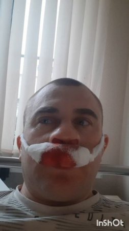 Здоровье.Операция на верхнечельстной пазухе.Фильм3.Серия3.Часть1.mp4