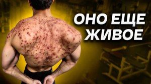 Гной Лезет Из Ушей / Последствия Стероидов