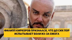 Филипп Киркоров признался, что до сих пор испытывает боли из-за ожога