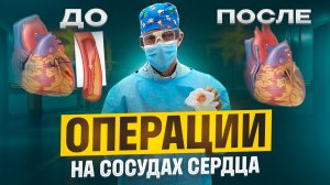 Операции на сосудах сердца: АКШ и стентирование. Что лучше? МИНУСЫ и плюсы.
