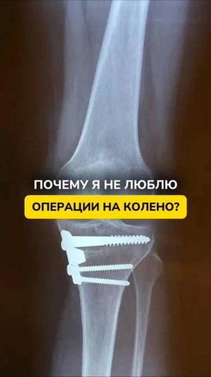 ПОЧЕМУ Я НЕ ЛЮБЛЮ 0ПЕРАЦИИ НА КОЛЕНИ?