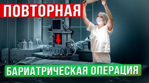 Повторная бариатрическая операция