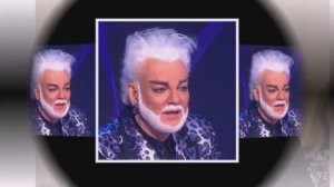 «Вата» на лысине и желтая кожа внешний вид больного Киркорова вызвал шок
