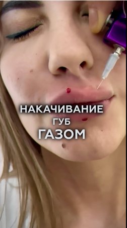 Газ для губ — ОПАСНО или ЭФФЕКТИВНО?! #губы #увеличениегуб #здоровье