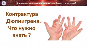 381 Контрактура Дюпиитрена 08