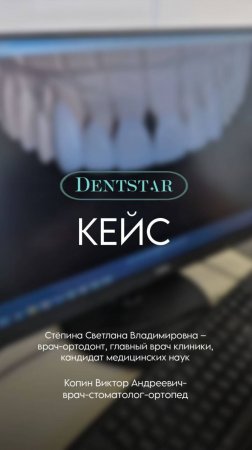 кейс