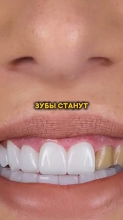 как похудеть без диет и спорта? #спорт #рецепт #зож #похудение #пп #нутрициолог #стресс #потерявеса