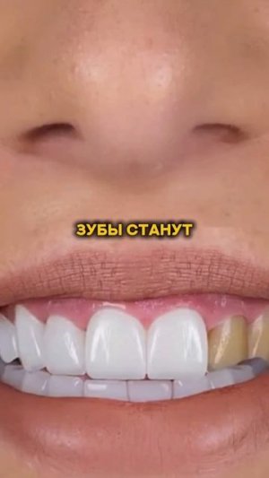 как похудеть без диет и спорта? #спорт #рецепт #зож #похудение #пп #нутрициолог #стресс #потерявеса