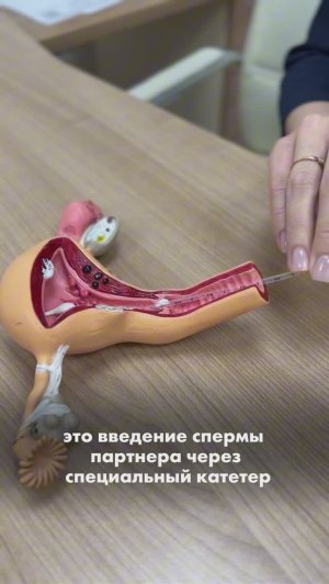 Внутриматочная инсеминация: подготовка, совместная работа врачей и эффективность