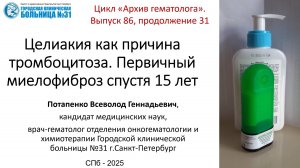 Архив 86. Целиакия как причина тромбоцитоза. Первичный миелофиброз спустя 15 лет