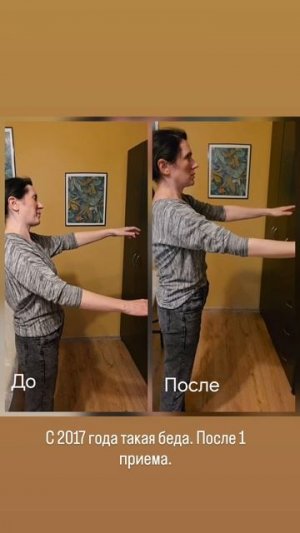 Плечо болит с 2017 года. 1 сеанс.mp4