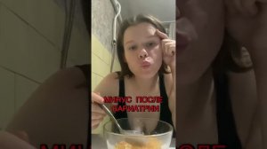 Минус бариатрии!