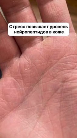как похудеть без диет и спорта? #спорт #рецепт #зож #похудение #пп #нутрициолог #стресс #потерявеса