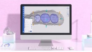 RAY DIGITAL SOLUTION 1m30s ver