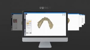 RAYDENT splint