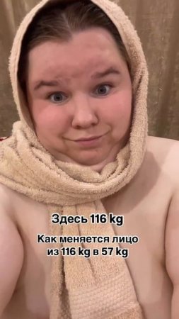 Беременный бариатрик. Показываю как худею, рассказываю.