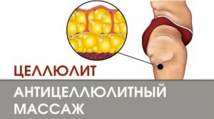 ПРИЧИНЫ ЦЕЛЛЮЛИТА И ОПАСНОСТЬ АГРЕССИВНОГО АНТИЦЕЛЛЮЛИТНОГО МАССАЖА