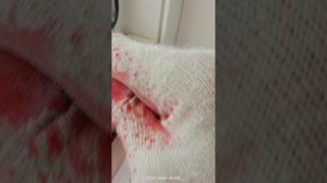 Монтаж стеклопакетов, и демонтаж