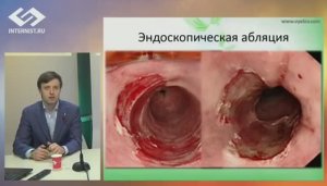 Рефлюксный синдром