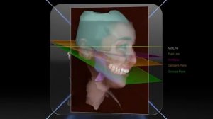 RAYFace 3D Facial Scanner