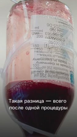🩸 Почему вы чувствуете усталость, даже если спали 8 часов?