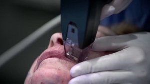 Morpheus8: презентация аппарата