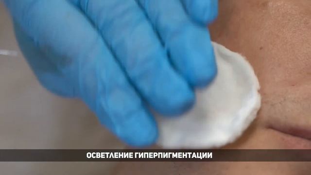 Преимущества биоревитализантов Revi смотреть онлайн