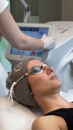 Эту процедуру в клинике «Гельтек» мы проводим на аппарате Lumenis М22.