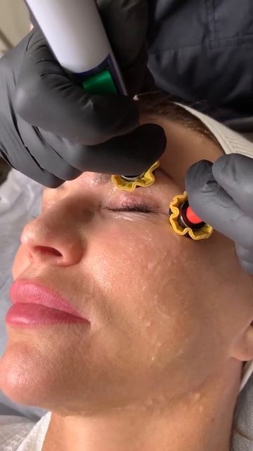 Vip Line Isogei: лицо смотреть онлайн