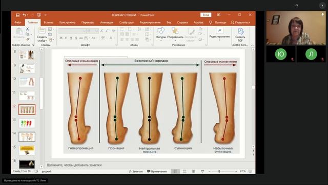 WHIEDA. Чудо-стельки с анионами