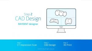 RAY Micro CT Digital Workflow