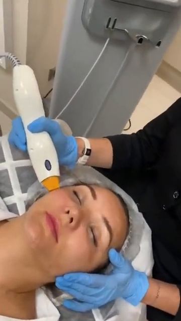 Термолифтинг на аппарате Thermage (Термаж) смотреть онлайн