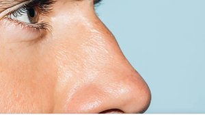 Юноша откусил нос мужчине в ходе разборок под Владимиром