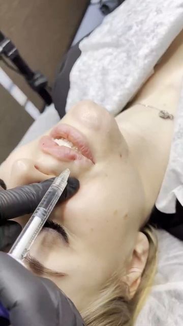 Повторная коррекция губ смотреть онлайн