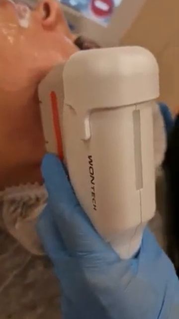 Процесс проведения SMAS-лифтинга на аппарате Ultra Skin II смотреть онлайн