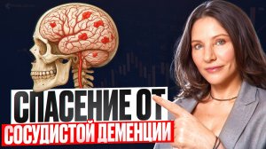 СОСУДИСТАЯ ДЕМЕНЦИЯ - ЧТО ЭТО ТАКОЕ? УЗНАЙТЕ РЕАЛЬНУЮ ПРИЧИНУ ЕЕ ПОЯВЛЕНИЯ