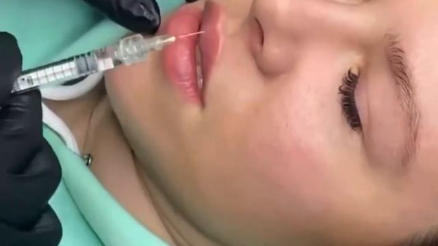 Моделирование формы губ + добавление объема смотреть онлайн