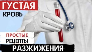 КАК РАЗЖИЖИТЬ КРОВЬ? Как вылечить тромбоз крови?