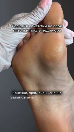 Что только не готовы терпеть девушки ради красоты😃