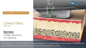 Ultight: об аппарате