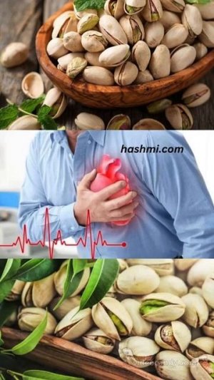 Amazing Benefits of Eating Pistachios