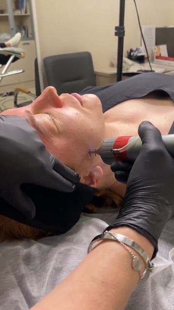 Фракционное омоложение (лазерный пилинг) на Action II смотреть онлайн