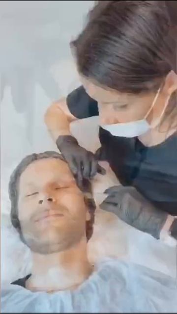 Пилинг BioRePeelCl3 смотреть онлайн