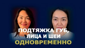 Комплексная пластика: подтяжка лица, шеи и губ