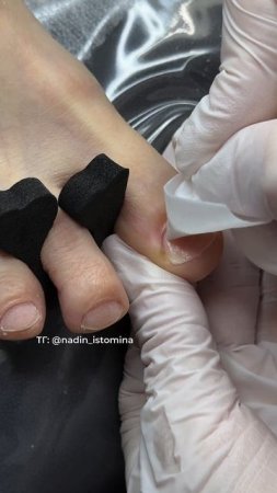 Почему я выбираю аппаратную обработку пальчиков, в том числе и на педикюре?👣