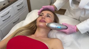 СМАС - лифтинг на аппарате Ultraformer в "Абрикосике"